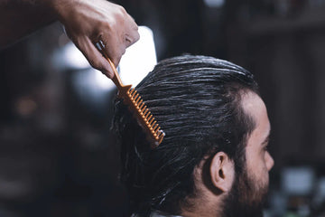 Explore Your Hair Transplant Options Today
