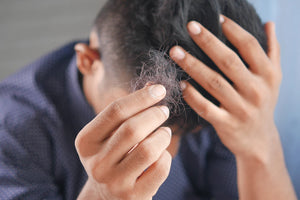 Effective Hair Care Kits for Men Struggling with Thinning Hair